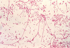 legionellapneumophila_gram.jpg