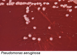 pseudomonas3.jpg