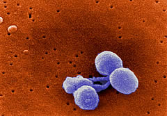 s-pneumoniae.jpg