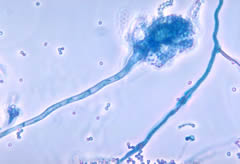 800px-aspergillus_fumigatus_01.jpg