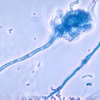 aspergillus2.jpg aspergillus2.jpg