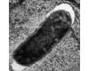 e._coli_cabecera.jpg