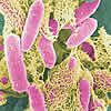 ecoli-entero.jpg