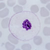 p.malariae.jpg