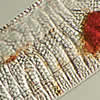 diatomeas