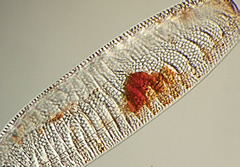 tierra diatomeas